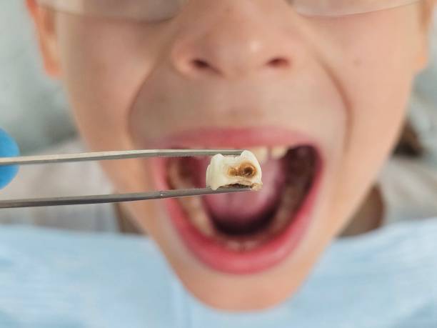 Best Emergency Broken Tooth Repair in Wanamassa, NJ